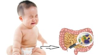 Viêm Ruột Ở Trẻ Em: Bố Mẹ Tuyệt Đối Không Lơ Là