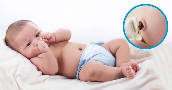 Toàn Bộ Thông Tin Cần Biết Về Bệnh Uốn Ván